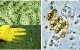 Нематоды в аквариуме: как избавиться от паразитов?