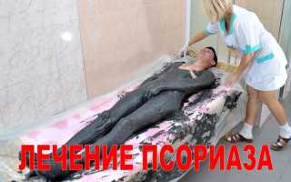 Псориаз море грязь мертвого моря